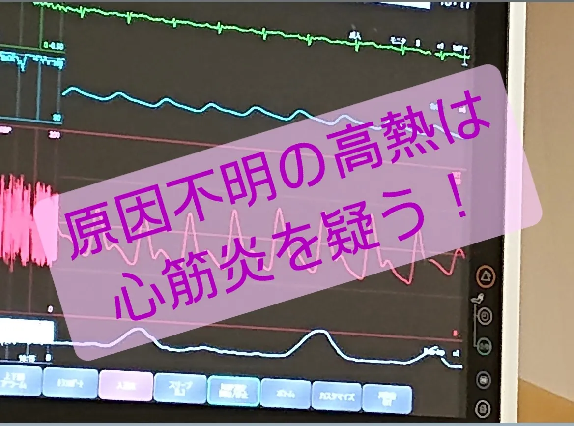 劇症型心筋炎になる人は、普段は強靱な身体の人かも！？